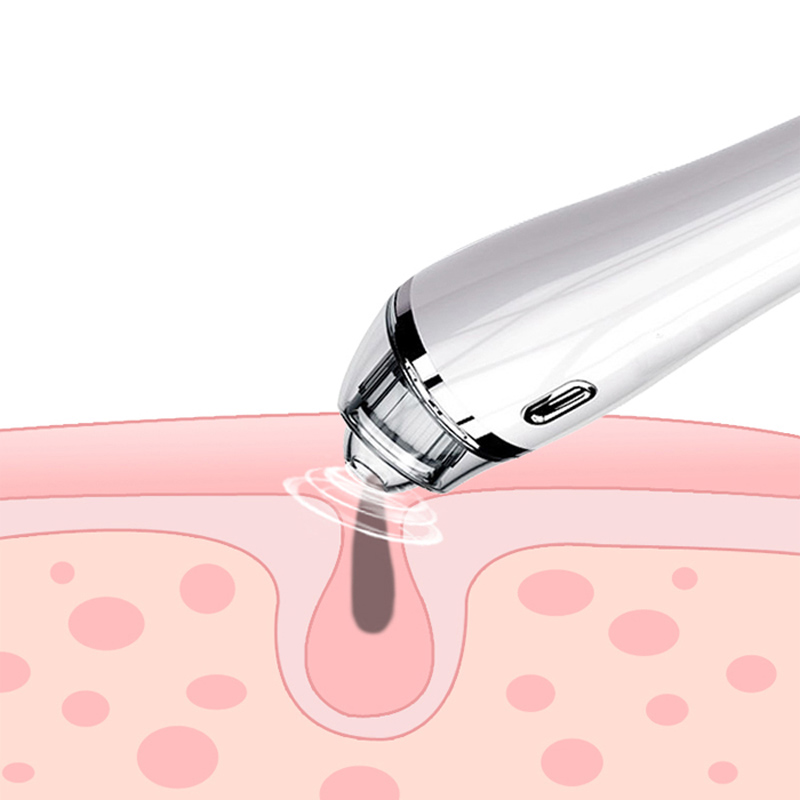 Blackhead Remover Vacuum - Outil d'extraction de comédons d'acné pour le visage de comédien de points noirs d'aspiration électrique pour femmes et hommes