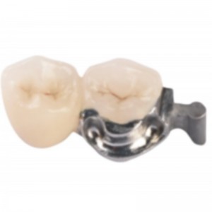 Attachement de précision